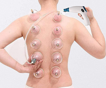Kit Ventouses Anti-Cellulite Électrique Professionnnel - Hijama 6 Ventouses Massage Dos avec Extension - Appareil Drainage Lymphatique Rechargeable